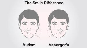 Differential Diagnosis: Autism vs. Asperger’s Syndrome
