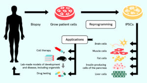 Autism and Stem Cell Research: Current Status and Ethics