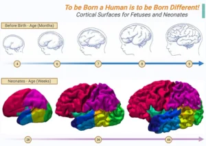 Autism and Brain Development: Current Findings